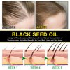 Black Seed Oil - 100% Virgin Cold Pressed Premium Black Seed Oil, Omega 3 6 9 Antioxidant, Immune Boost, Joints, Skin & Hair, Glass Bottle 2.02 fl oz