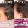 Hair Growth Vitamins for Visibly Thicker & Stronger Hair - Supplements for Hair Loss Treatment and Thinning Hair in Women