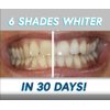 Smileactives Prolite Professional Teeth Whitening Kit, LED Light + Whitening Gel Pen (Spearmint Splash), Dental Quality Stain Removal, Teeth Whitener for White Teeth & Smile, Teeth Whitening Products
