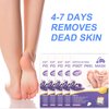 5 Packs Foot Peel Mask Exfoliating Callus Peel Natural Exfoliator Foot Mask for Dry Cracked Feet for Men and Women Feet Peeling Mask
