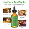 Rosemary Hair Growth Oil and Serum - Dry Scalp Treatment, Hair Thickening Products for Women, Hair Loss Essential Oils for Diffuser (2OZ)