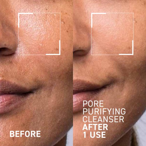 Dr. Brandt Pores No More Purifying Cleanser - Non-Drying Gel - Cleanses, Purifies, and Dissolves Excess Oil, Residue, and Debris - 3.5 fl oz / 105 ml