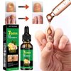 Ginger Nail Treatment Nail Support Nail Care, 7days Nail Treatment, Ginger Nail Growth Serum, Ginger Cuticle Care Oil for Nails,Cuticle Serum for Nails (2Pcs, 1 Fl.oz(pack of 1))