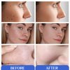 Glycolic Acid Pads,Glycolic Acid Peel Pads with 10% Ultra Pure Glycolic + 2% Salicylic Acid,Cleansing Pads for Face & Body with Vitamins B3, C & E, Green Tea, Calendula, Allantoin - 60 Pads