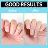 Teenitor Cuticle Care kit with Cuticle Remover and Cuticle Oil, Cuticle Softner and Cuticle Revitalizing Oil, Cuticle Remover Oil