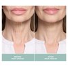 Contours RX Neck Rescue - Anti-Aging Neck Strips for Crepey Skin - Tighten, Lift and Firm Fine Lines and Wrinkles - Long Lasting Treatment - Organic, Hypoallergenic, Latex Free (30 Count)