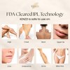 Kenzzi IPL PRO Hair Removal Device - IPL Laser Hair Removal and Rejuvenating Technology - Pain-Free at Home Laser Hair Removal for Whole Body Treatment