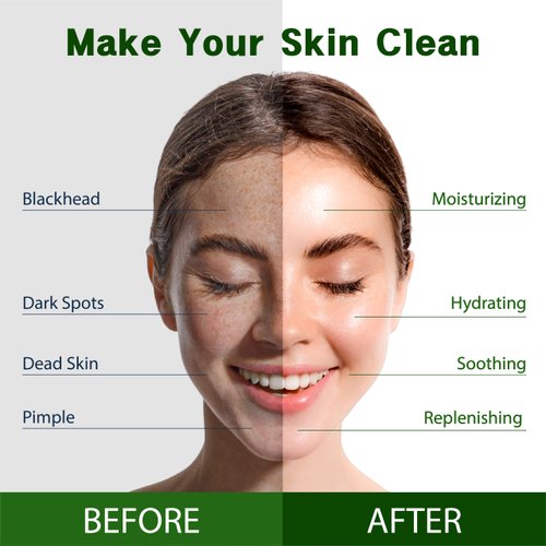 Purederm Vegan Aloe Sheet Masks (12 Packs) – Facial Sheet Mask for Soothing & Hydrating Treatment