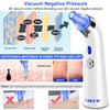 Blackhead Remover Pore Vacuum, Face Suction Pore Cleaner, 5 Suction Power Electric Blackhead Suction Remover, Extractor Tool, 4 Probes for Women & Men (Blue）