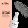 OZIDEX Procutin Rosacea | Dermatitis | Acne | Solution to Demodex | Natural Herbal Formula
