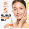 NETINA Skin Restart Dark Spot Serum - Turmeric, Niacinamide, Vitamin C, 30 mL