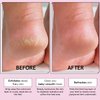 grace & stella Award-Winning Foot Peeling Mask - Foot Peel Masks (2 Pairs, Lavender) - Moisturizing Foot Masks That Remove Dead Skin, Exfoliating Foot Mask for Dry Cracked Feet, Feet Peeling Mask