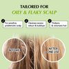 RATED GREEN REAL MARY Exfoliating Scalp Shampoo - Rosemary Scalp Scrub & Hair Shampoo | Gentle Scalp Moisturizer & Dry Scalp Shampoo | Itchy Scalp Shampoo Organic Rosemary Hair Shampoo 13.52 fl oz