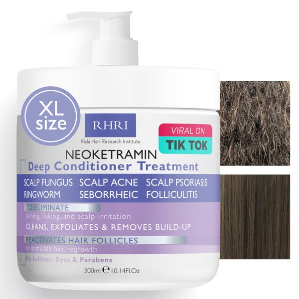 Anti Fungal Conditioner for Men & Women, Anti Dandruff, Medicated, Folliculitis Conditioner for Dry Scalp, Psoriasis, Ringworm, for Itchy, Flaky and Irritated Scalp Deep Conditioner Treatment