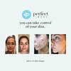 Perfect Image Salicylic Acid Deep Exfoliating Gel Based Cleanser, Professionally Formulated Salicylic Acid Peel Peel Prep Cleanser, Enhanced with Tea Tree Oil and Green Tea Extract