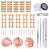 105 pcs Ingrown Toenail Removal Kit Ingrown Toenail Pedicure Tools with Ingrown Toenail Sticker, Toenail Clippers, Toenail File, Toenail C-type Tube