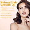 Natural Hair Growth Oil, Natural Hair Growth Oil for Thin Hair, Rosemary Oil for Hair Growth Organic, Hair Oil for Dry Damaged Hair and Growth for Women Men (1PCS)