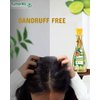 Kumarika Nourishing Hair Oil Dandruff Control - For Anti dandruff scalp treatment hair oil for dry damaged hair. 100% Natural extracts, for dry itchy scalp with dandruff, 7 oz