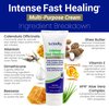 TriDerma Intense Fast Skin Healing Cream for Hard-to-Heal Skin Irritations, Sores, Rashes, Dry, Cracked Hands, Cuts, Chafing, Burns, Scrapes - First Aid Kit Essential - FSA Eligible - 4.0 oz Tube