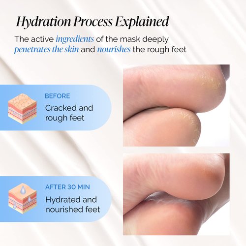 Hydrating Foot Mask for Dry & Cracked Feet - NOT Peeling - 4 Pack Hydrating Socks for Soft Heels - Intense Moisturizing and Repairing Dry Rough Skin - Foot Spa - Happy Feet Mask by Plantifique
