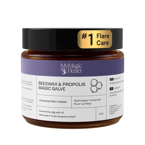 Beeswax & Propolis Magic Salve | Universal Flare Care | For 100+ Skin Issues | Boils | Cysts | Abscesses | Hidradenitis Suppurativa | Eye Stye | For Swollen, Infected, Tender and Painful Skin (2oz)