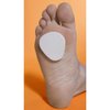 Metatarsal Pads, 25 pad Pack, 1/4" Adhesive Foam, Ball of Foot Cushions