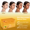 Ficod Kojic-Acid-Soap, 2Pack Turmeric Soap for Dark spots with Vitamin C, Vitamin E,Retinol, Collagen, Turmeric - Original,Olive Oil,Hyaluronic Acid for Reduces Dark Spots