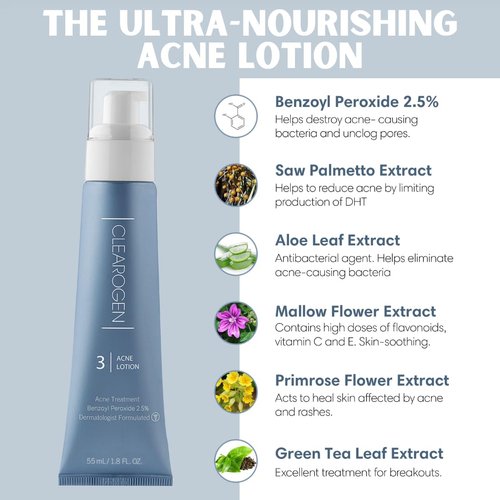 Clearogen Acne Lotion with Benzoyl Peroxide, Acne Cream, Face Moisturizer Acne Prone Skin, Acne Moisturizer for Face, 1.8 Fl oz