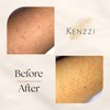Kenzzi IPL PRO Hair Removal Device - IPL Laser Hair Removal and Rejuvenating Technology - Pain-Free at Home Laser Hair Removal for Whole Body Treatment