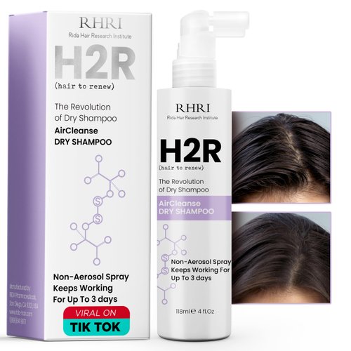 Dry Shampoo for Instant Oil Absorption & Freshness | Non-Aerosol Dry Shampoo | Best for All Hair Types, Ideal for On-the-Go, Post Workout, Travel | Vitamin Enriched, Clarifying Formula | 4 fl.oz