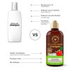 WOW Skin Science Apple Cider Vinegar Shampoo - Hair Growth Shampoo For Thinning Hair, Hair Loss & Dandruff Shampoo - Parabens & Sulfate Free Shampoo (Brown, 16.9 Fl Oz (Pack Of 1))