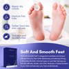 SPINOSUM Foot Peel Mask (2 Pairs) for Baby Soft Skin Remove Dead Skin, Dry, Cracked Feet & Callus, Spa, Made with Aloe Vera Extract Women and Men Peeling Exfoliating, Lavender