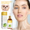 Nigrifix Green Tangerine Vita C Dark Spot Serum,Vitamin C Face Serum,for Face Serum with Hyaluronic Acid & Vitamin E,Anti Aging, Anti Wrinkle Skin 1.01 fl oz