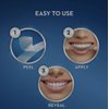 Crest 3D White Professional Effects Whitestrips Teeth Whitening Strips Kit, 40 Strips (20 Count Pack)