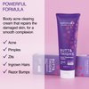 Seroflora Butt & Thighs Acne Treatment Cream - Butt Acne Clearing Cream for Pimples, Zits, Razor Bumps, Dark Spots - Acne Clearing Lotion for Buttocks & Body - Inner Thigh Blackhead Remover (4oz)