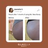 EllaBella Ms. New Booty Scrub - Walnut Exfoliator, Acne Treatment | Reduce Keratosis Pilaris