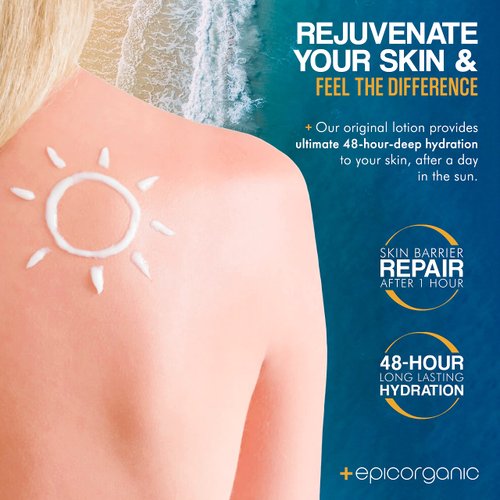 Epic Organicum After Sun Lotion | Sunburn Relief | Aloe Vera & Vitamin E Cream | Body Lotion & Face Moisturizer | Lotion for Dry Skin | Itchy Skin Relief | Moisturizer Face Cream | 8 oz