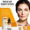 Dermaxgen 20% Vitamin C Serum + Hyaluronic Acid + Retinol + Vitamin E + Vitamin B PURE ORGANIC- Boost Skin Collagen, Moisturizer, Anti Aging & Wrinkle Facial Serum (8 FL OZ)