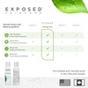 Exposed Skin Care Clearing Tonic Facial Toner with 1% Salicylic Acid and Witch Hazel for Acne Treatment – Pore Minimizing Toner to Prevent Breakouts, Reduce Redness and Balance Skin – Step 2 (4 fl oz)