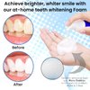 Swissklip Foam Toothpaste Also a Teeth Whitener in The Market I We Offer Best Teeth Whitening Products for Professional Teeth Whitening Kit I Best Teeth Whitener 4 U