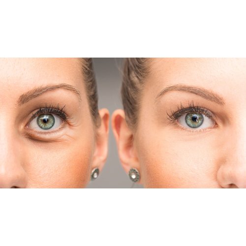 Su-Skin Anti Aging Eye Cream, Bright Eyes, Daily Wrinkle Cream for Firming, Dark Circles, Puffiness