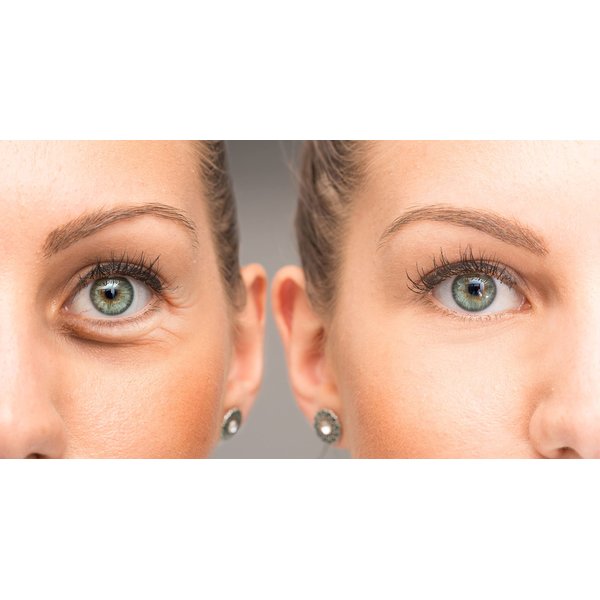 Su-Skin Anti Aging Eye Cream, Bright Eyes, Daily Wrinkle Cream for Firming, Dark Circles, Puffiness