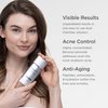 Jan Marini Skin Research Age Intervention Duality - Acne & Anti-Aging Support Face Cream - Clear Skin Support - Beauty & Skincare Product - 1 oz