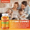 VAJYKEWJY L-Lysine Gummies 1000 mg for Immune Support, Delicious Orange Flavor, Vegan, Non-GMO, Gluten-Free – 120 Count