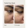 Topicals Faded Starter Kit, The Brightening & Clearing Bundle - Faded Serum for Dark Spots (0.5oz) and Faded Under Eye Masks (Set of 6)