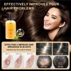 Ginger Plant Extract Anti Hair Loss Shampoo for Hair Regrowth, Thickening and Longer Hair - For Women & Men (400ML)