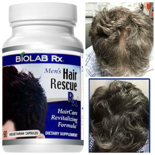Hair Rescue Rx Men's - Hair Growth Vitamins w/ Biotin, Nettle - for Hair Loss & Thinning, Supports Thicker Healthier Hair Growth - Vitamins for Hair Loss & Thinning - Natural Solution Supplement
