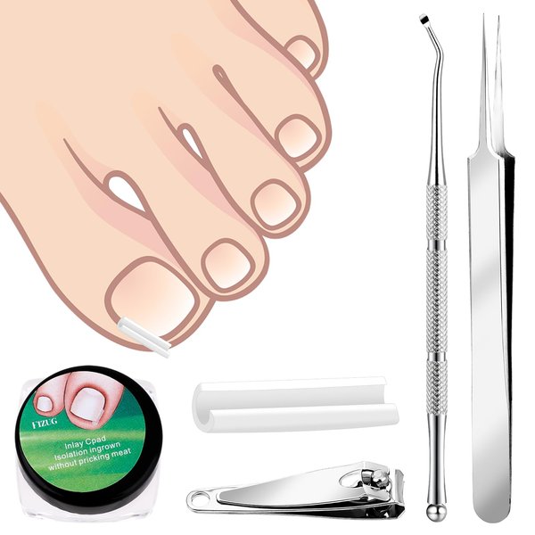 Jeffdad Ingrown Toenail Treatment Kit, 60 Pcs Ingrown Toenail Corrector Strips with Ingrown Toenail Lifter And Nail Clipper, Easy Use Ingrown Toenail Removal Tools