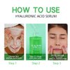 Peauamie Hyaluronic Acid Serum for Face with Vitamin C,Vitamin E, Hydrating Facial Serum Skin Care