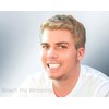 Teeth Whitening Gel Syringe Dispensers 35% Carbamide Peroxide Tooth Bleaching 20 Dispensers 3ml